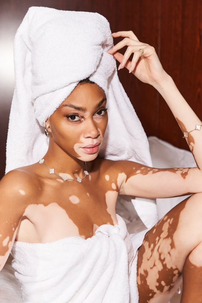 Cay_Skin_WinnieHarlow_SvenjaAva_3