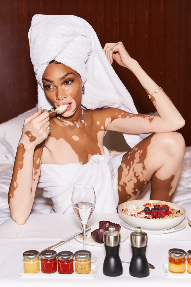 Cay_Skin_WinnieHarlow_SvenjaAva_4 Kopie