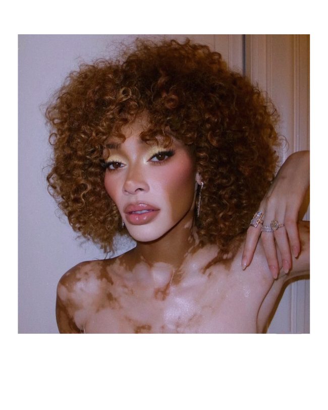 Winnie Harlow