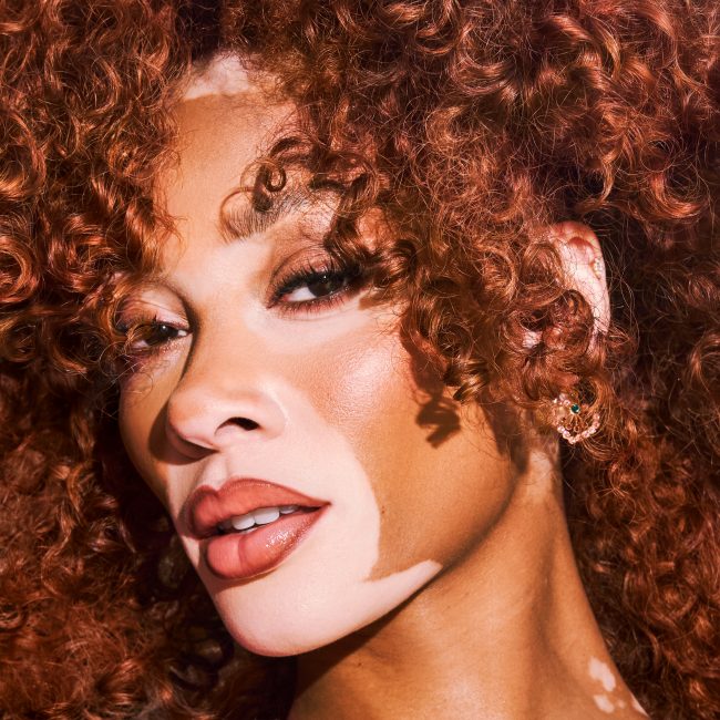 Winnie Harlow_SvenjaAva_1