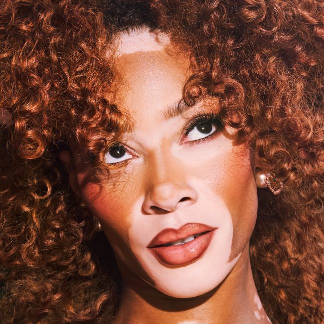 Winnie Harlow_SvenjaAva_2