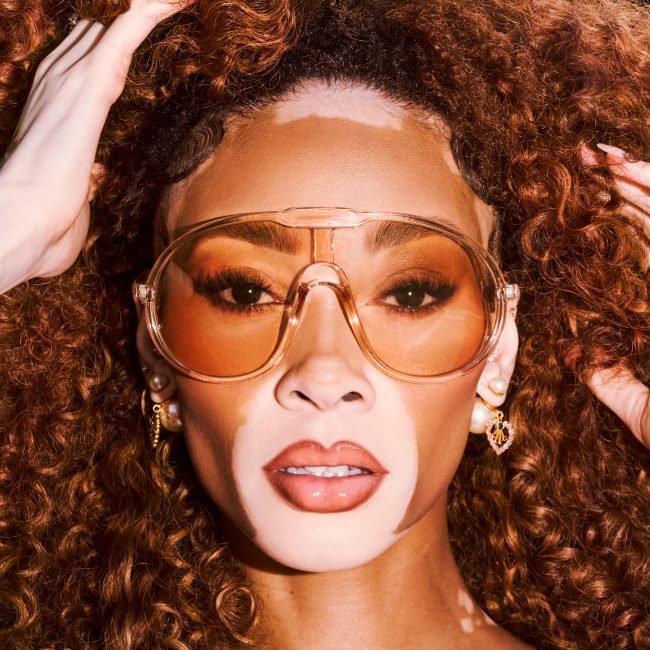 Winnie Harlow_SvenjaAva_4