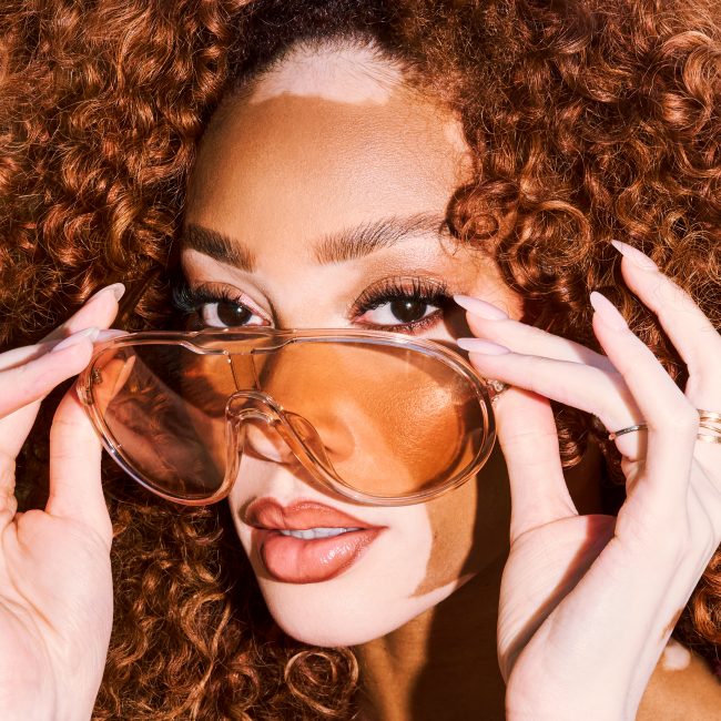 Winnie Harlow_SvenjaAva_6