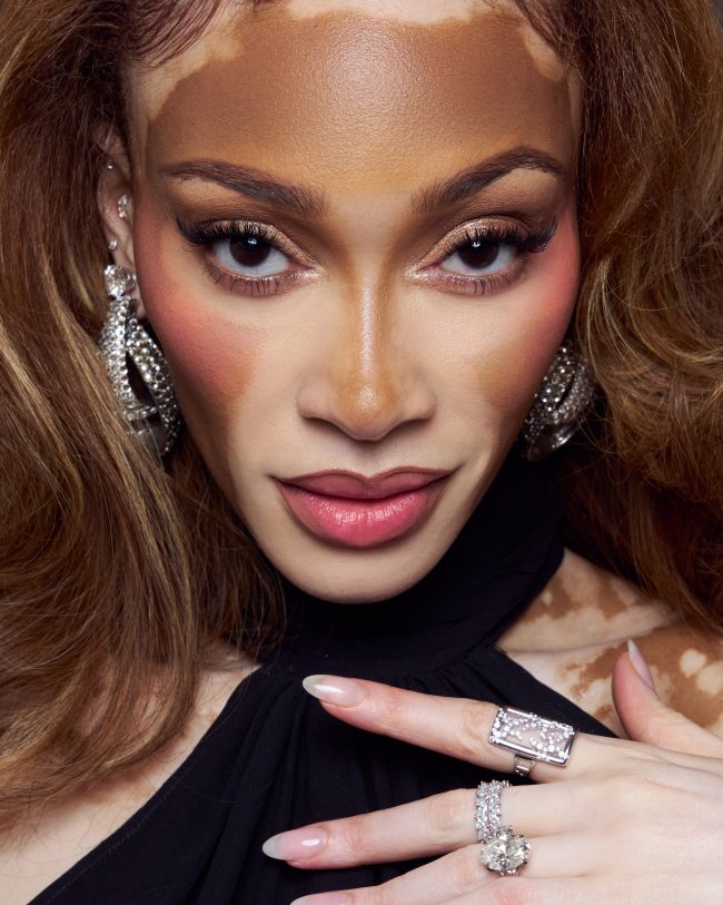 WinnieHarlow_AP_PFW_SvenjaAva_12