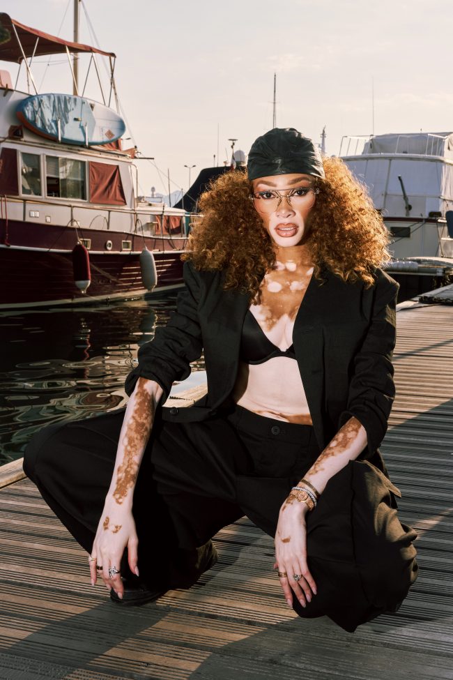 WinnieHarlow_SvenjaAva_4